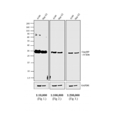 山羊抗兔（二抗）